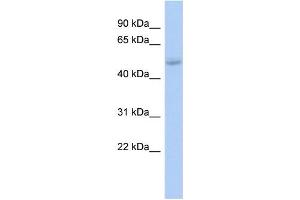 WB Suggested Anti-LHX5 Antibody Titration: 0. (LHX5 Antikörper  (Middle Region))