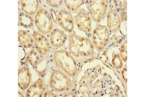 Immunohistochemistry of paraffin-embedded human kidney tissue using ABIN7174174 at dilution of 1:100