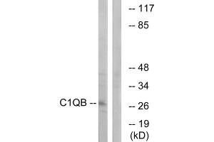 Western blot analysis of extracts from Jurkat cells, using C1QB antibody. (C1QB Antikörper  (C-Term))