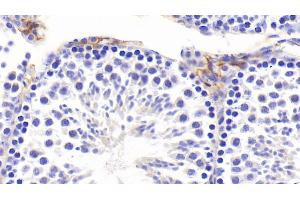 Immunohistochemistry (IHC) image for anti-Procollagen III N-Terminal Propeptide (PIIINP) (AA 24-154) antibody (ABIN7445201)
