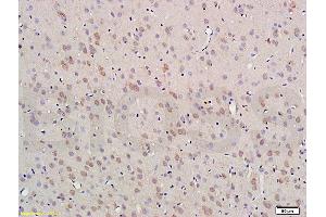 Formalin-fixed and paraffin embedded rat brain labeled with Anti-Nestin Polyclonal Antibody (ABIN723530), Unconjugated 1:300 followed by conjugation to the secondary antibody and DAB staining