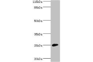Western blot All lanes: CALN1 antibody at 2 μg/mL + Mouse brain tissue Secondary Goat polyclonal to rabbit IgG at 1/10000 dilution Predicted band size: 25, 30 kDa Observed band size: 25 kDa (Calneuron 1 Antikörper  (AA 1-192))
