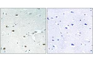 Immunohistochemistry analysis of paraffin-embedded human brain tissue, using Retinoblastoma (Ab-826) Antibody. (Retinoblastoma Protein (Rb) Antikörper  (AA 601-650))