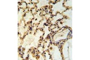 Immunohistochemistry analysis in formalin fixed and paraffin embedded rat lung tisssue reacted with IMMP2L Antibody (Center) followed by peroxidase conjugation of the secondary antibody and DAB staining. (IMMP2L Antikörper  (Middle Region))