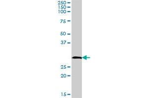 Western Blotting (WB) image for anti-Major Histocompatibility Complex, Class II, DR beta 1 (HLA-DRB1) (AA 1-266) antibody (ABIN516510)