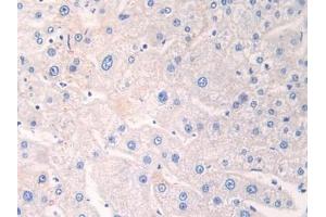 Detection of ADRP in Human Liver Tissue using Polyclonal Antibody to Adipose Differentiation Related Protein (ADRP) (ADRP Antikörper  (AA 245-433))