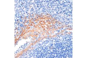 Immunohistochemistry of paraffin-embedded human tonsil using AREG antibody (ABIN6127431, ABIN6137065, ABIN6137066 and ABIN6216408) at dilution of 1:100 (40x lens). (Amphiregulin Antikörper  (AA 20-252))