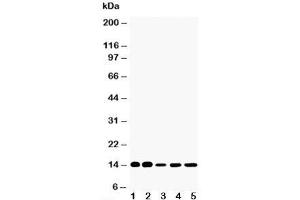 Western blot testing of FABP1 antibody and Lane 1:  rat liver;  2: rat kidney;  3: HeLa;  4: (mouse) Neuro-2a;  5: (human) SMMC-7721 cell lysate (FABP1 (liver) Antikörper  (N-Term))
