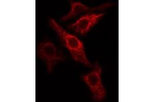 ABIN6274786 staining COLO205 cells by IF/ICC. (PGLS Antikörper  (C-Term))