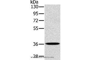 Western blot analysis of A172 cell, using PDLIM1 Polyclonal Antibody at dilution of 1:400 (PDLIM1 Antikörper)