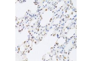 Immunohistochemistry of paraffin-embedded rat lung using SFN Antibody. (14-3-3 sigma/SFN Antikörper  (AA 1-248))