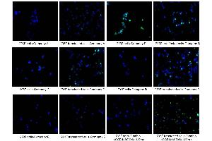 Immunofluorescence staining of 293F cells and 293F transfected cells with Company A, Company B, Company C, Company D, Company E, ABIN7193151 at 1:100, counter-stained with DAPI. (HA-Tag Antikörper)