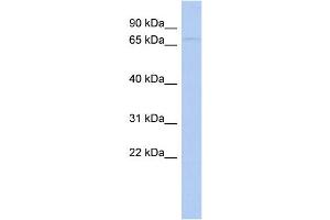 WB Suggested Anti-WDPCP Antibody Titration: 0. (WDPCP Antikörper  (N-Term))