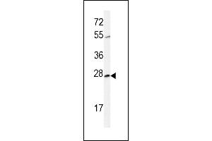 Western blot analysis of CWC15 Antibody (Center) (ABIN651004 and ABIN2840035) in CHO cell line lysates (35 μg/lane). (CWC15 Antikörper  (AA 123-152))
