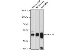 Western blot analysis of extracts of various cell lines, using HMGCS2 antibody (ABIN6292123) at 1:1000 dilution. (HMGCS2 Antikörper)