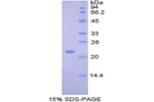 SDS-PAGE (SDS) image for REX2, RNA Exonuclease 2 Homolog (REXO2) (AA 41-213) protein (His tag) (ABIN1877622)