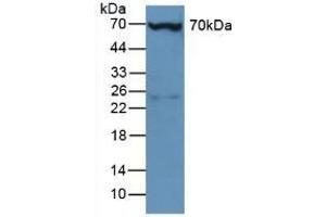 Detection of PLS3 in Mouse Liver Tissue using Polyclonal Antibody to Plastin 3 (PLS3) (Plastin 3 Antikörper  (AA 5-251))