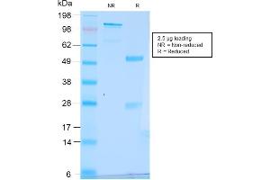 SDS-PAGE Analysis Purified pS2 Rabbit Recombinant Monoclonal Antibody (TFF1/2969R). (Rekombinanter TFF1 Antikörper  (AA 57-84))