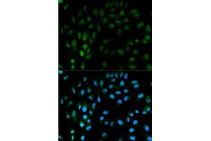 Immunofluorescence analysis of MCF-7 cells using TFPI antibody. (TFPI Antikörper)