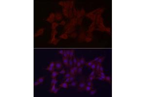 Immunofluorescence analysis of PC-12 cells using WDR45 Rabbit pAb (ABIN6133064, ABIN6150194, ABIN6150195 and ABIN6223490) at dilution of 1:100 (40x lens). (WDR45 Antikörper  (AA 1-360))