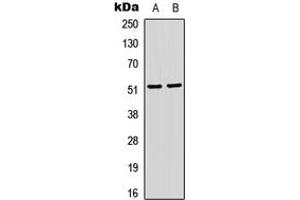 Western blot analysis of SRF (pS103) expression in HeLa (A), Jurkat (B) whole cell lysates. (SRF Antikörper  (pSer103))