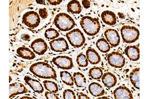 ABIN7093238 and ABIN7097250 at 1/100 staining Rat stomach tissue by IHC-P. (H2AFX Antikörper  (H2AK9ac))