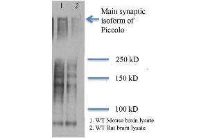 Western Blot analysis of Rat and mouse brain lysates showing detection of Piccolo protein using Mouse Anti-Piccolo Monoclonal Antibody, Clone 6H9-B6 .