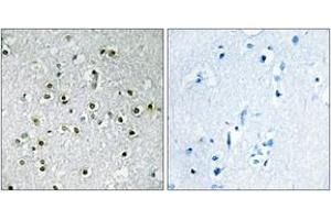 Immunohistochemistry (IHC) image for anti-Transcription Factor E3 (TFE3) (AA 101-150) antibody (ABIN2889417) (TFE3 Antikörper  (AA 101-150))