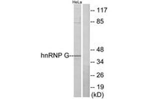 Western Blotting (WB) image for anti-RNA Binding Motif Protein, X-Linked (RBMX) (AA 6-55) antibody (ABIN2889468) (RBMX Antikörper  (AA 6-55))