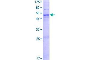 Image no. 1 for DnaJ (Hsp40) Homolog, Subfamily C, Member 22 (DNAJC22) (AA 1-341) protein (GST tag) (ABIN1351810) (DNAJC22 Protein (AA 1-341) (GST tag))