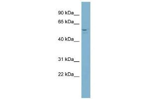ACD antibody used at 1 ug/ml to detect target protein. (ACD Antikörper)