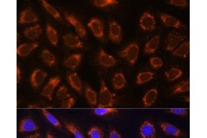 Immunofluorescence analysis of U-2 OS cells using GANAB Polyclonal Antibody at dilution of 1:100. (GANAB Antikörper)