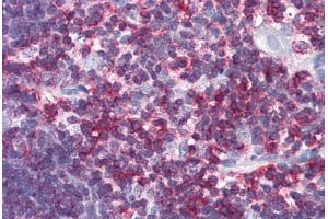 Human Thymus (formalin-fixed, paraffin-embedded) stained with CD45 antibody ABIN337379 at 10 ug/ml followed by biotinylated goat anti-rabbit IgG secondary antibody ABIN481713, alkaline phosphatase-streptavidin and chromogen. (CD45 Antikörper  (C-Term))