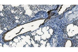 IHC analysis of MCU using anti-MCU antibody (ABIN7601931).