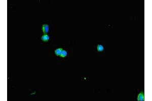 Immunofluorescent analysis of HepG2 cells using ABIN7150849 at dilution of 1:100 and Alexa Fluor 488-congugated AffiniPure Goat Anti-Rabbit IgG(H+L) (DNAAF3 Antikörper  (AA 1-209))