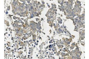 IHC analysis of Claudin 3/CLDN3 using anti-Claudin 3/CLDN3 antibody (ABIN7602816). (Claudin 3 Antikörper  (C-Term))