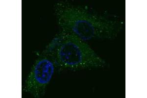 Immunofluorescence (IF) image for anti-Met Proto-Oncogene (MET) antibody (ABIN2995275) (c-MET Antikörper)