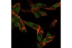 Immunofluorescence (IF) image for anti-CUGBP, Elav-Like Family Member 2 (CELF2) antibody (ABIN7504156)