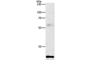 Western Blot analysis of Mouse lung tissue using FGF2 Polyclonal Antibody at dilution of 1:1000 (FGF2 Antikörper)