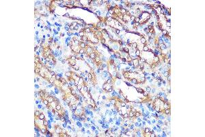 Immunohistochemistry of paraffin-embedded rat kidney using Bcl-XL Rabbit pAb (ABIN3020685, ABIN3020686, ABIN1512625 and ABIN6213668) at dilution of 1:100 (40x lens). (BCL2L1 Antikörper  (AA 1-120))