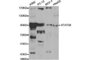 Western blot analysis of extracts of various cell lines, using STAT5B antibody. (STAT5B Antikörper  (AA 40-280))