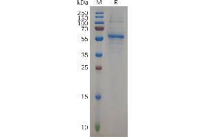 SDS-PAGE (SDS) image for GTPase Kras (KRAS) (AA 2-185) protein (Fc Tag) (ABIN6964285)