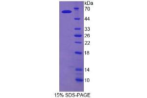 SDS-PAGE analysis of Rat TDP1 Protein. (TDP1 Protein)