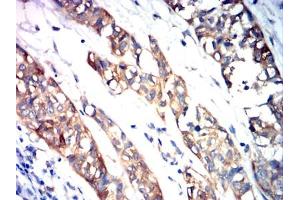 Immunohistochemistry (IHC) image for anti-Endothelial PAS Domain Protein 1 (EPAS1) (AA 680-870) antibody (ABIN7193981)