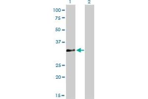 Western Blotting (WB) image for anti-Homeobox C4 (HOXC4) (AA 160-264) antibody (ABIN561336)