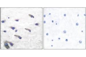 Immunohistochemistry analysis of paraffin-embedded human brain, using PDGF Receptor beta (Phospho-Tyr751) Antibody. (PDGFRB Antikörper  (pTyr751))