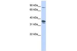 Image no. 1 for anti-Solute Carrier Organic Anion Transporter Family, Member 3A1 (SLCO3A1) (AA 360-409) antibody (ABIN6740849) (Solute Carrier Organic Anion Transporter Family, Member 3A1 (SLCO3A1) (AA 360-409) Antikörper)