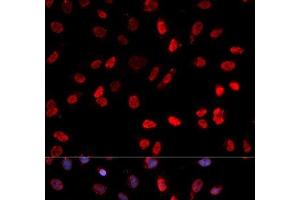 Immunofluorescence analysis of MCF-7 cells using Phospho-ATF2(T71) Polyclonal Antibody (ATF2 Antikörper  (pThr71))