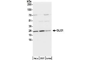 Western Blotting (WB) image for anti-Glyoxalase I (GLO1) (AA 134-184) antibody (ABIN7450286)