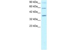 Western Blotting (WB) image for anti-PRKC, Apoptosis, WT1, Regulator (PAWR) antibody (ABIN2460368) (PAWR Antikörper)